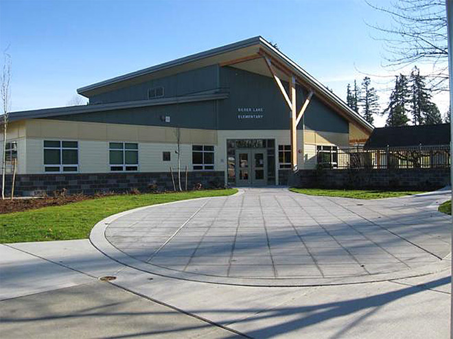  Picture of SLE